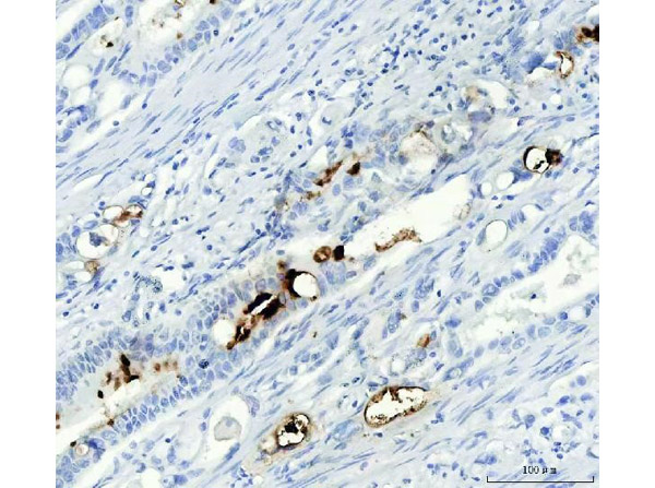 Immunohistochemistry analysis of Mucin Gastric